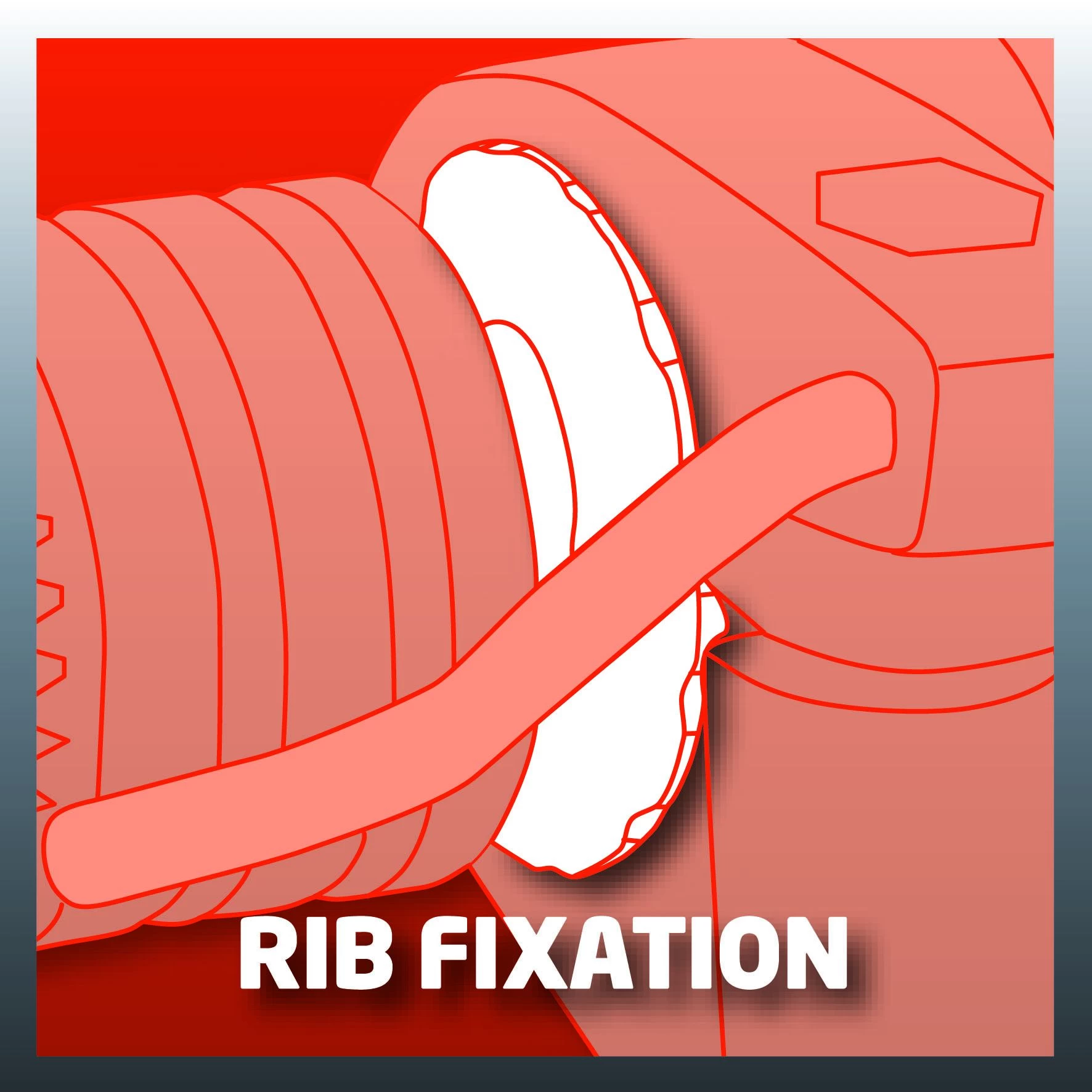 Einhell TC-ID 1000 E Klopboormachine - 1010W - 32mm 9 Einhell TC-ID 1000 E Klopboormachine - 1010W - 32mm - Afbeelding 9